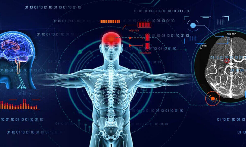 Neurological Diseases